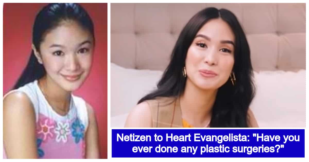 Heart Evangelista denies undergoing plastic surgeries on her face