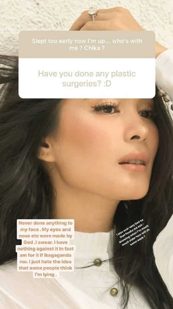 Heart Evangelista denies undergoing plastic surgeries on her face