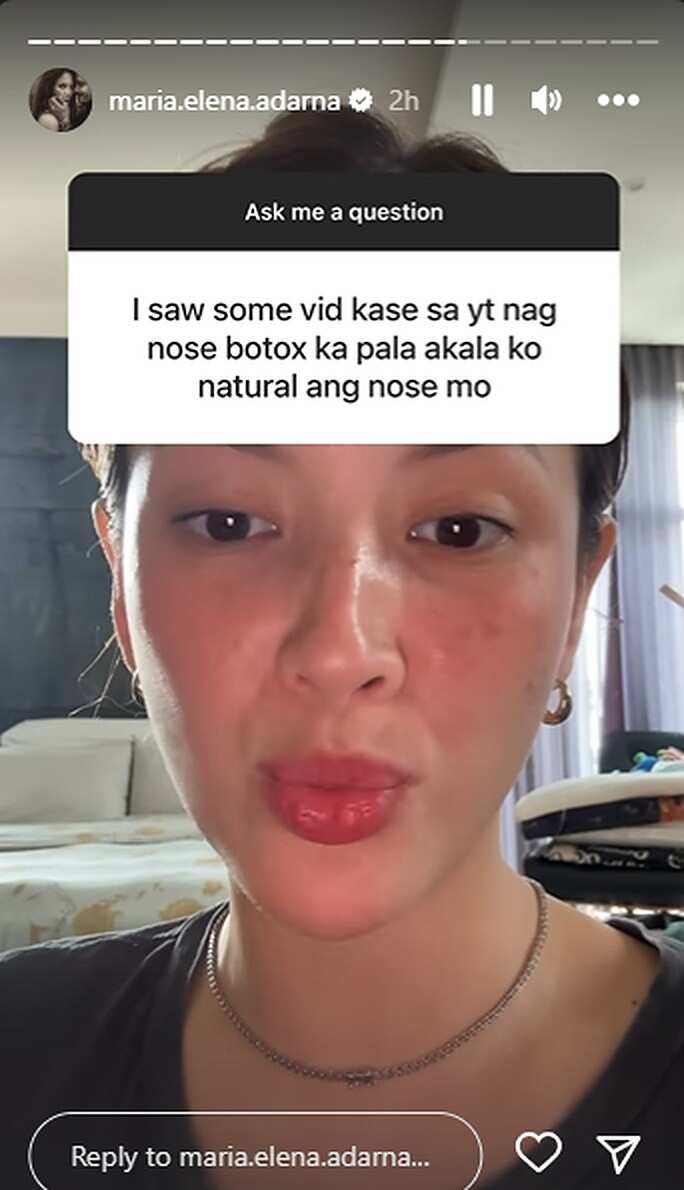 Ellen Adarna Aminado Na Sumailalim Sa Nose Botox Noong Active Sya Sa