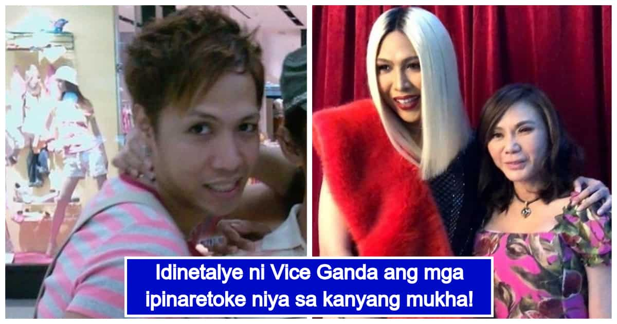 Vice Ganda Umaming Pina Retoke Ang Ibat Ibang Bahagi Ng Kanyang Mukha Kamicomph 4990