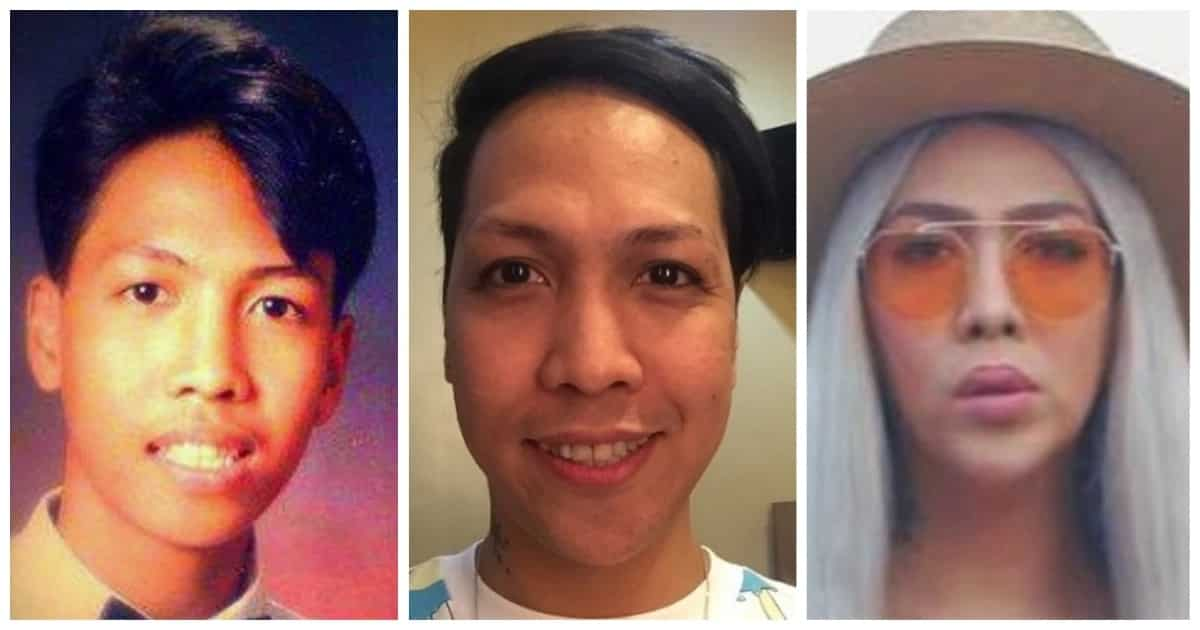 Vice Ganda Opens Up About Undergoing Cosmetic Surgeries - KAMI.COM.PH