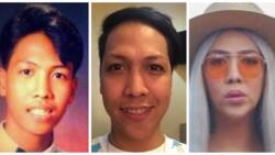 Guilty or not guilty? Vice Ganda opens up about undergoing cosmetic surgeries