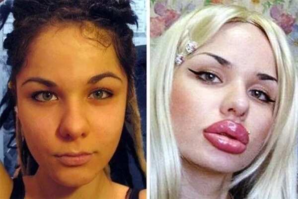 These 7 ladies turned out for the worse after failed surgeries