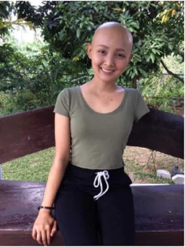Teeange girl na naputulan ng kaliwang braso dahil sa cancer, kinakitaan parin ng positibong pananaw sa buhay