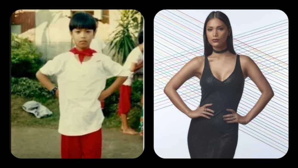 6 Remarkable Pinoy transgender before and after surgery 6 Remarkable Pinoy transgender before and after surgery