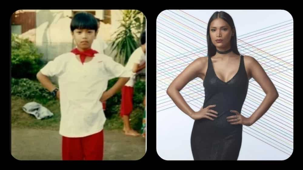 6 Remarkable Pinoy transgender before and after surgery