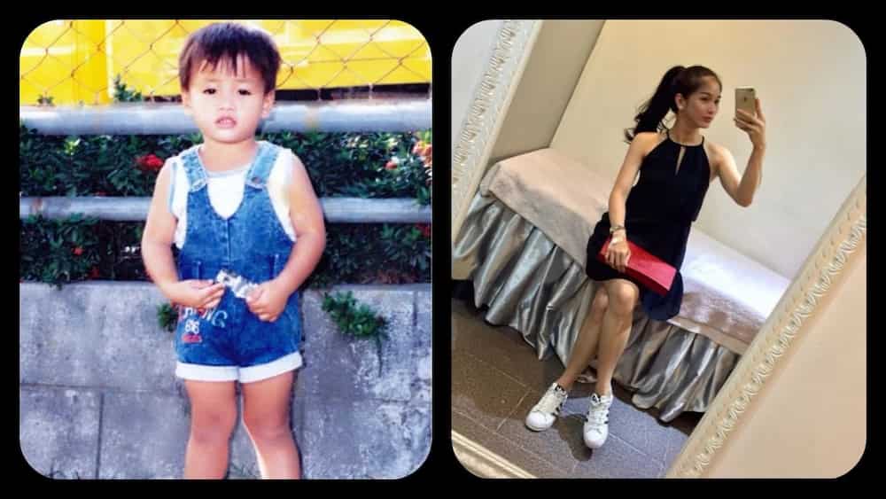 6 Remarkable Pinoy transgender before and after surgery 6 Remarkable Pinoy transgender before and after surgery