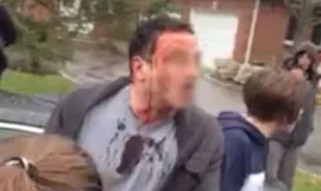 A Dad Trying To Protect His Son Gets Absolutely Destroyed By A Pack Of Teens