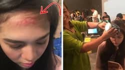 Janella Salvador naaksidente sa shooting. Elmo Magalona alalang alala!