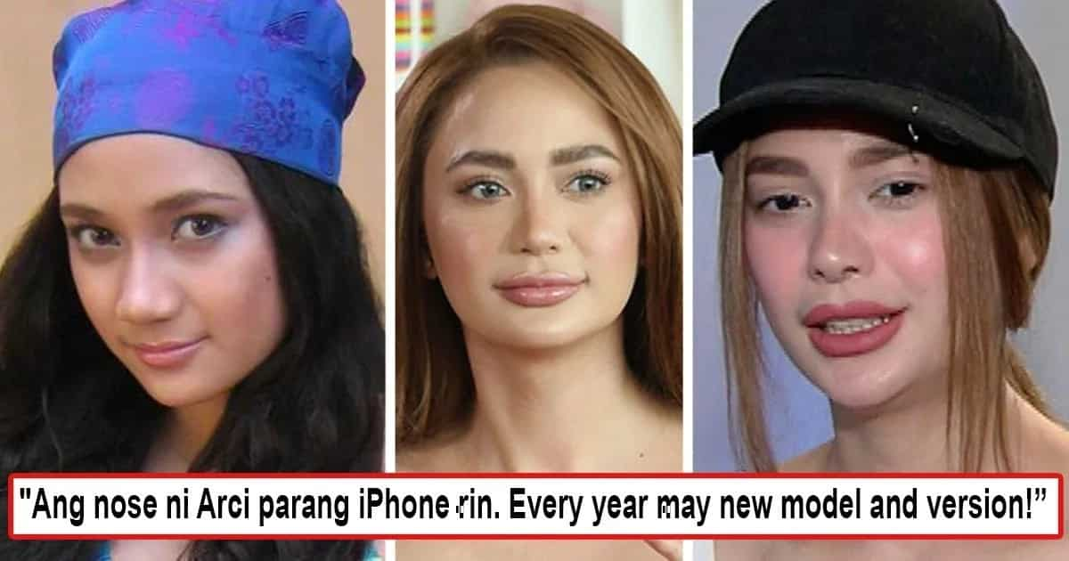 Arci Muñoz's Nose Gets Much Attention For Being A 'new Model' Every ...