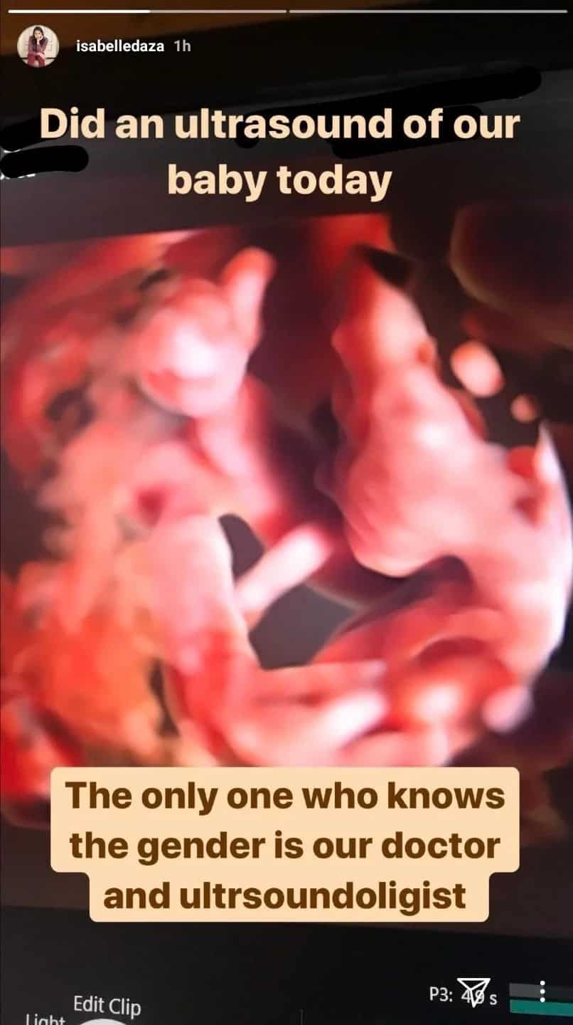 Pregnant Isabelle Daza wows netizens by sharing ultrasound of her first baby