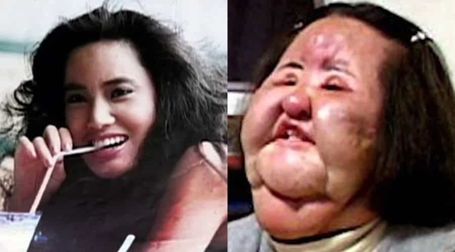 These 7 ladies turned out for the worse after failed surgeries