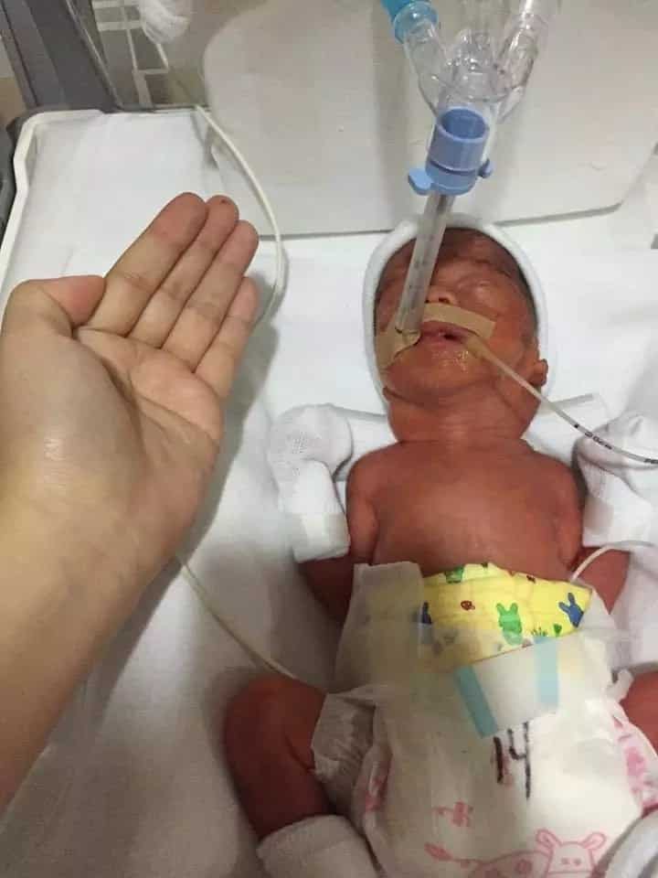 Pinay mother shares miraculous recovery of premature baby