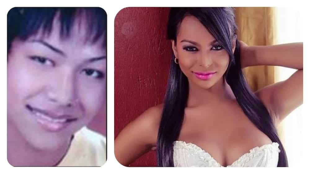 6 Remarkable Pinoy transgender before and after surgery
