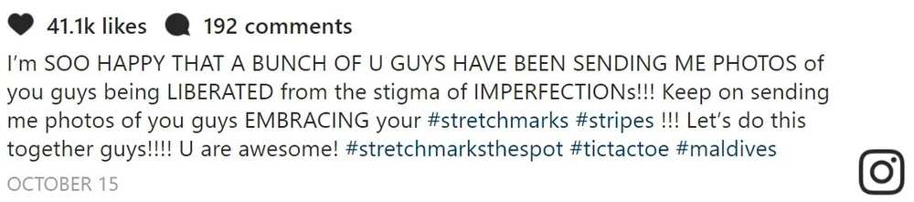 Denise Laurel proud of her stretch marks; encourages women to embrace their "stripes" Denise Laurel proud of her stretch marks; encourages women to embrace their "stripes"