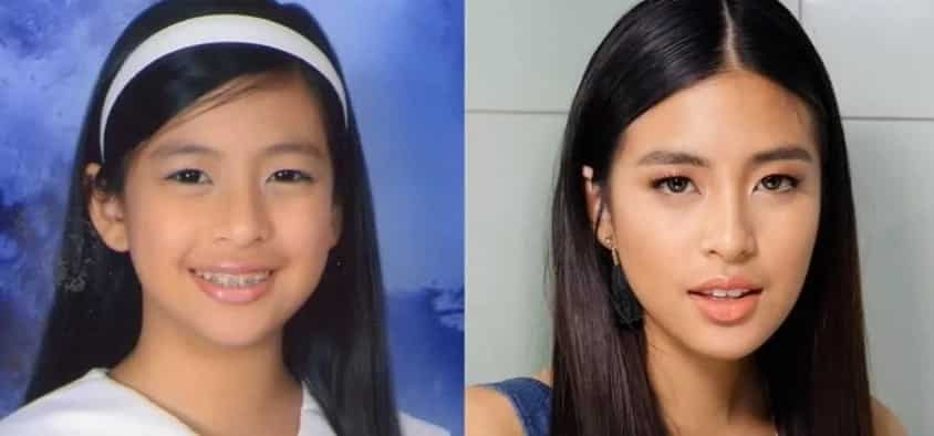 Noon at ngayon: These 16 Filipina celebrities experienced drastic transformation after hitting puberty