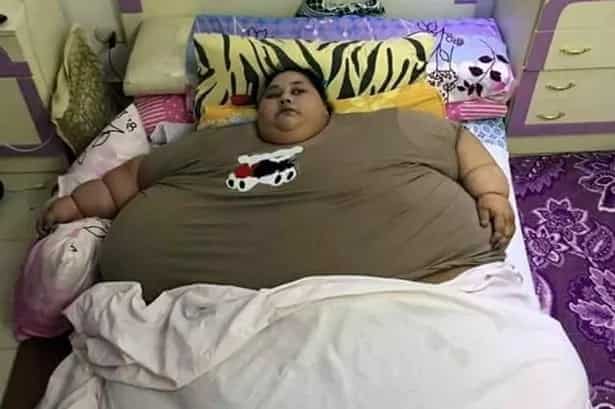 This Woman Believed To Be Fattest Female On Earth As Weight Reaches 79 STONE