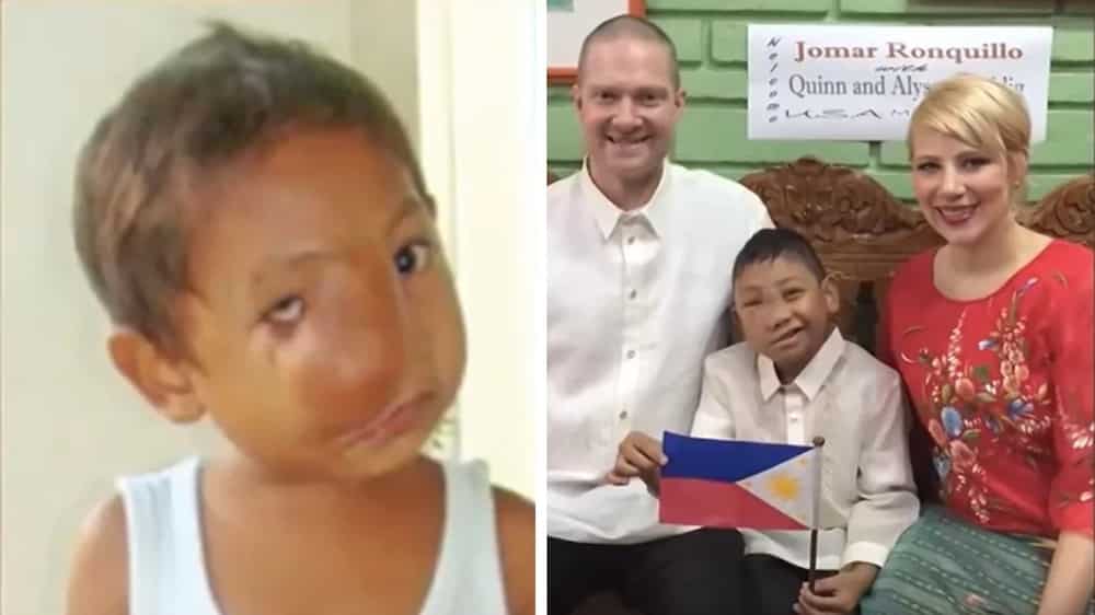 Pinoy orphan gets new name, new face, and new life in America