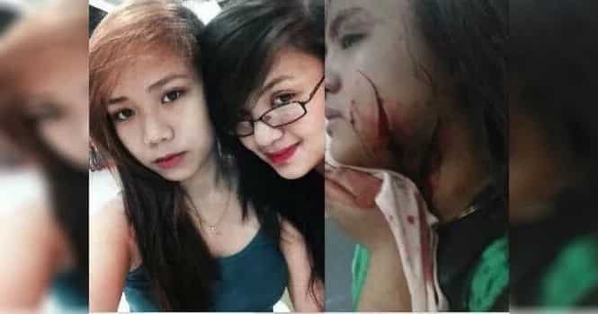 Young woman's face slashed after BF forever got jealous