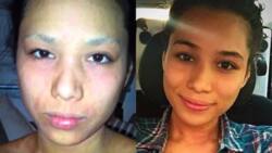This beauty queen used to have skin problems, but look at her now!