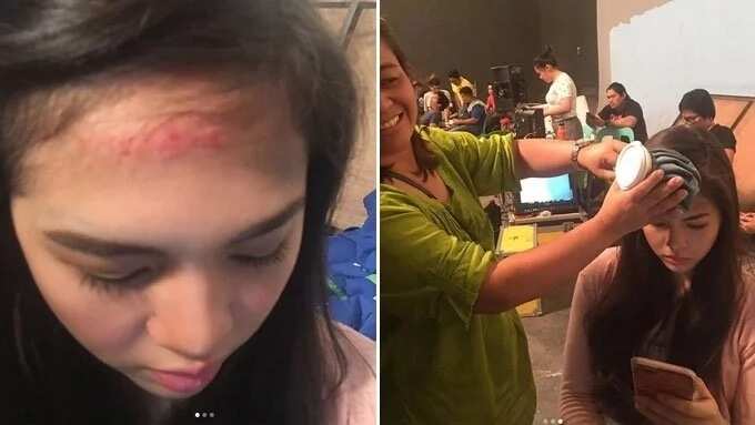 Janella Salvador naaksidente sa shooting. Elmo Magalona alalang alala!