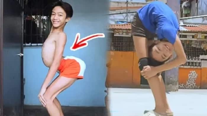 "Flexible Flexi-Boy” Just Got Real! Netizens Are Stunned by This Boy's Bone-Breaking Antics!