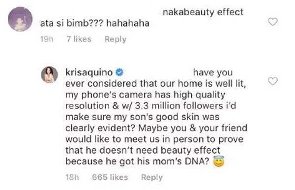 Kris Aquino dismisses 'beauty effect' accusation on Bimby's IG photo