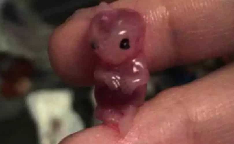 Woman Takes Abortion Pill, Sees Her 7-Week-Old Baby