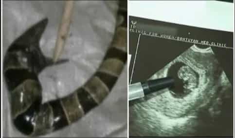 Woman gave birth to a snake in Cotabato