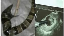 WATCH: This woman just gave birth to a snake