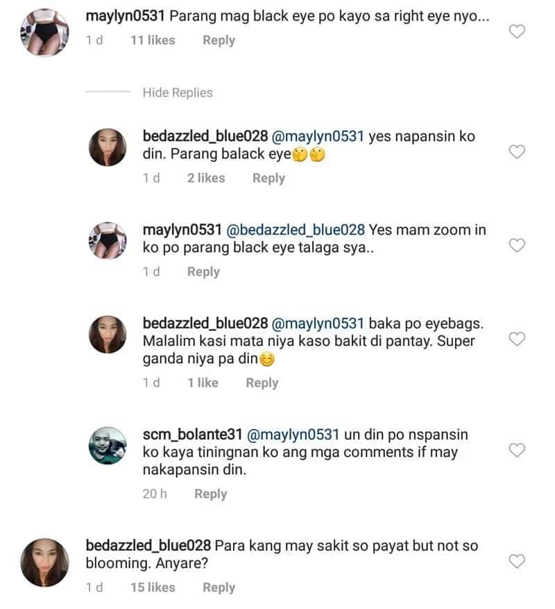 Ugly black marks around Maxene Magalona's eye leave netizens speculating on her situation