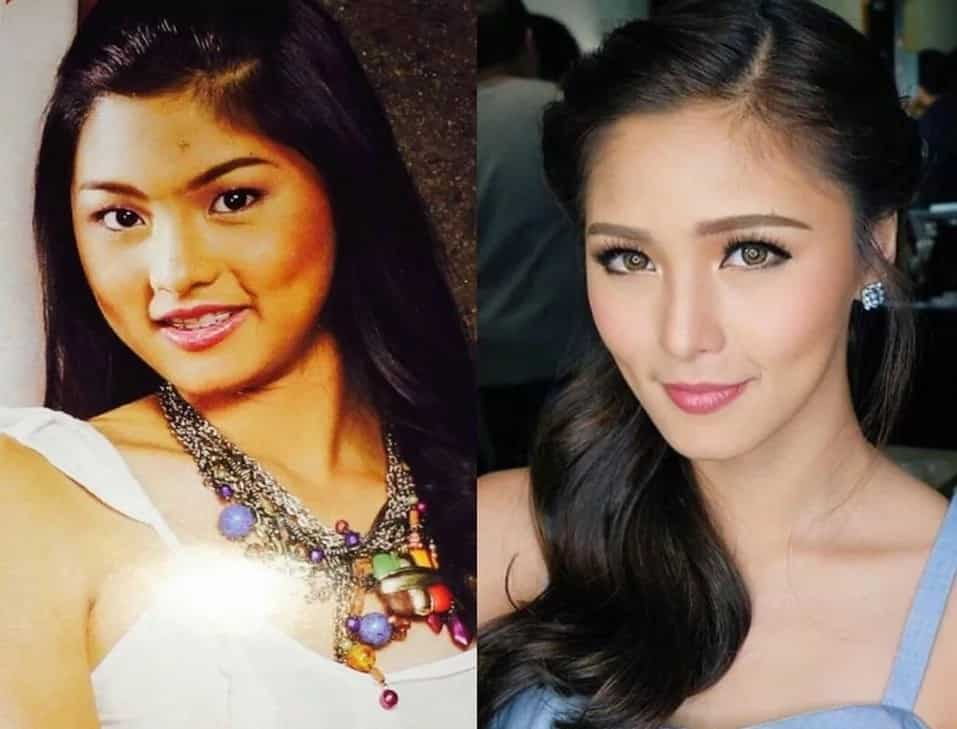 This is how these Filipina celebrities looked like before