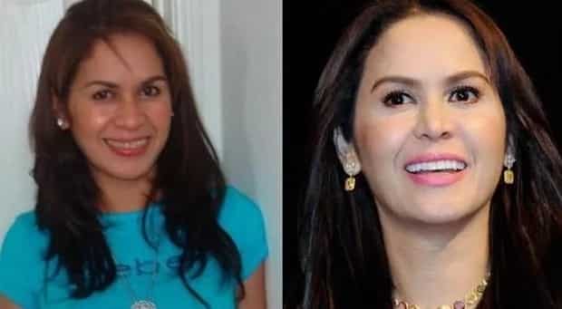 Jinkee Pacquiao's before and after photos are shocking