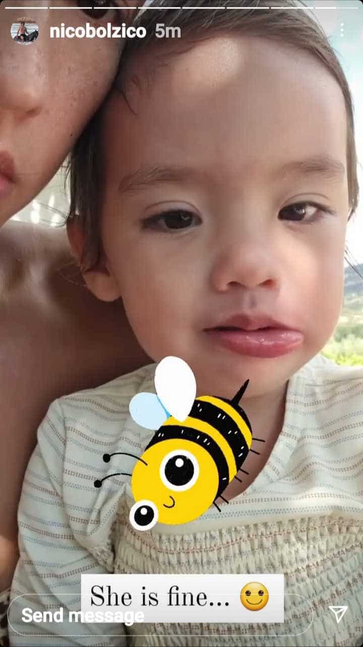 Baby Thylane’s lip gets stung by a bee; netizens worried for the baby girl