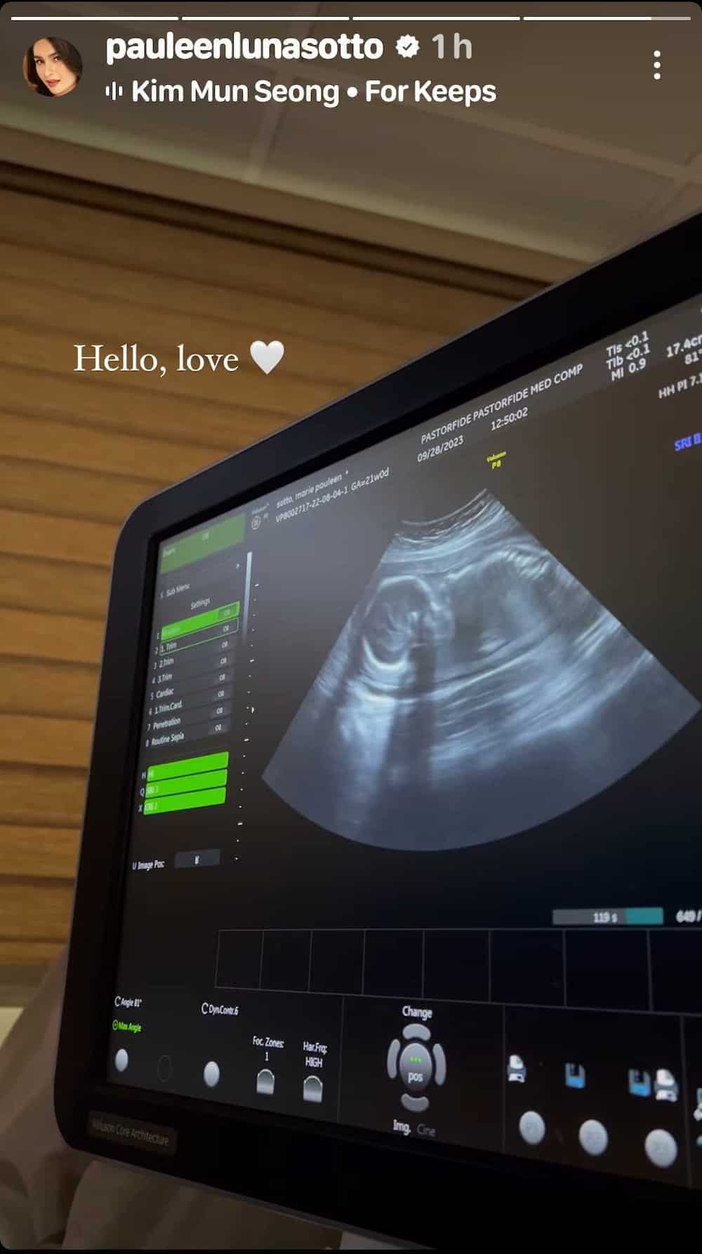 Pauleen Luna shares ultrasound video of her, Vic Sotto’s 2nd baby together Pauleen Luna shares ultrasound video of her, Vic Sotto’s 2nd baby together