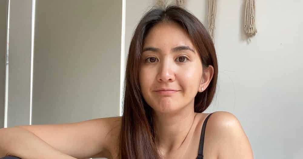 Rica Peralejo bravely opens up about undergoing plastic surgery