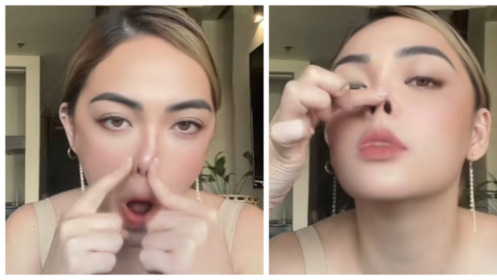 Meg Imperial posts video to address question if she had nose enhancement