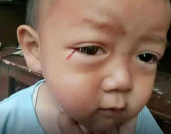 Pagluha ng dugo ng anak, sinisi ng ina sa sobrang paggamit ng gadget