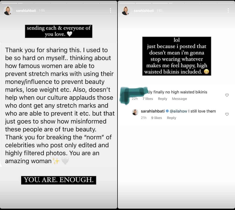Netizens rally behind Sarah Lahbati's viral post about flaunting her stretch marks