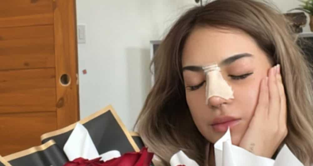 Vlogger Mika Salamanca, ipina-retoke ang ilong; nanay niya, na-stress sa nangyari