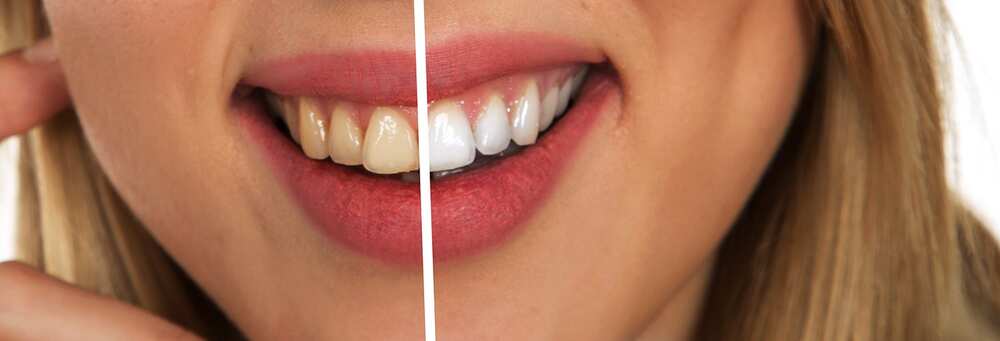 Activated charcoal for teeth Activated charcoal for teeth