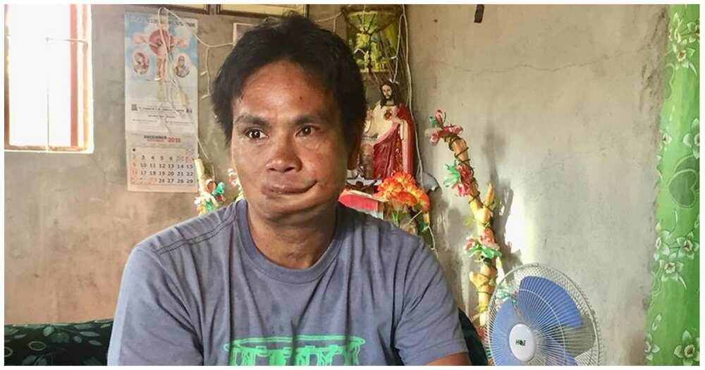 1 sa sundalong nakipaglaban sa Marawi, nasira ang mukha at humihiling ng tulong