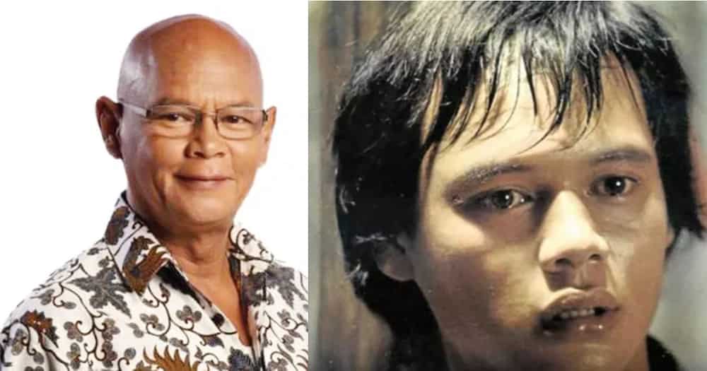 8 Famous bald celebrities when they still had hair 8 Famous bald celebrities when they still had hair