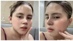 Antonette Gail lectures people bashing her looks after nose surgery