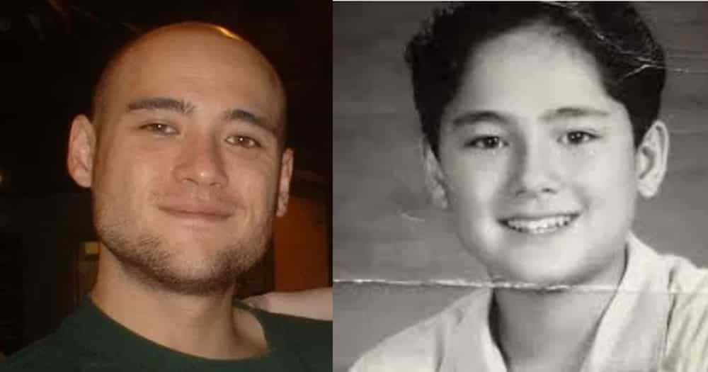 8 Famous bald celebrities when they still had hair 8 Famous bald celebrities when they still had hair