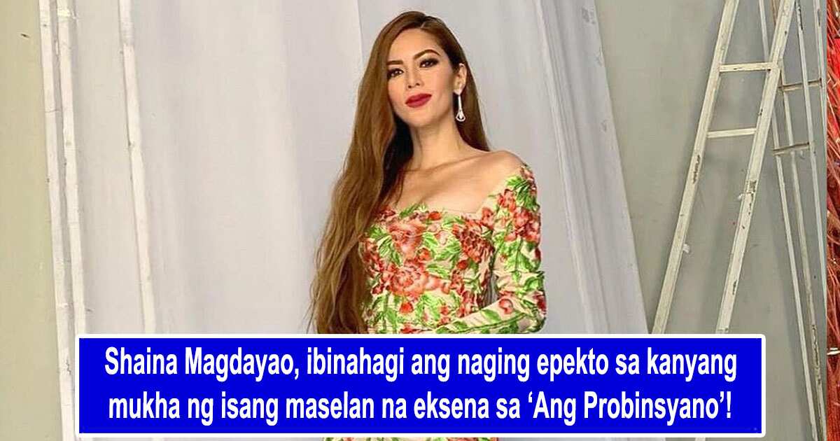 Shaina Magdayao, Ibinahagi Pumutok Ilang Ugat Sa Mukha Dahil Sa Maselan ...