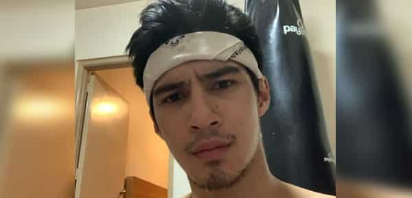 Albie Casiño, inaalala pa rin ang kapakanan ni Anji Salvacion, kahit nasa labas na ng bahay ni Kuya