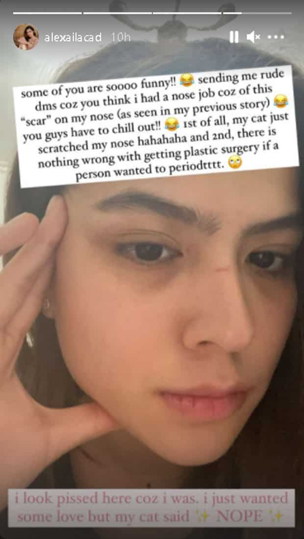 Alexa Ilacad, bongga ang resbak sa rude bashers na inakusahan siyang nagpa nose job