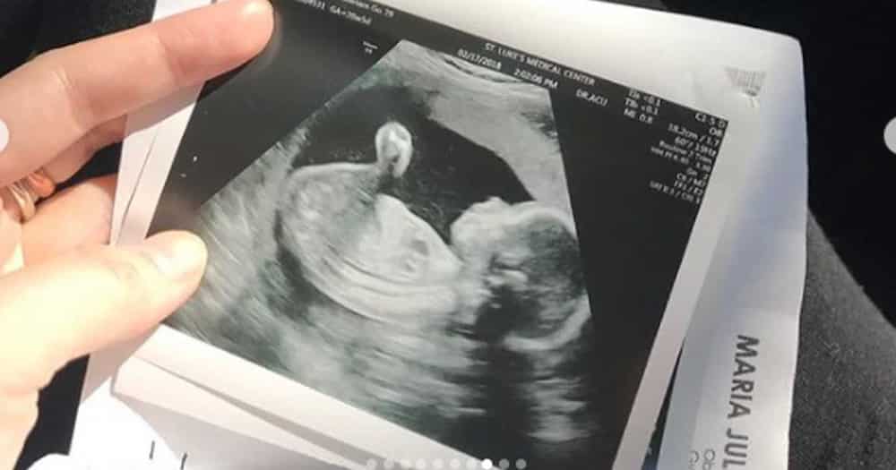 Ellen Adarna shares her treasured pregnancy photo and sonogram of Baby Elias
