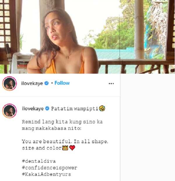 Kakai Bautista reminds public about beauty amid conflict with Mario Maurer’s agency